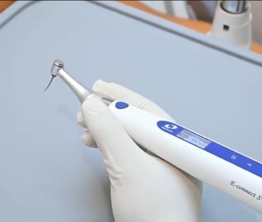 MÁY NỘI NHA ECONNECT S+